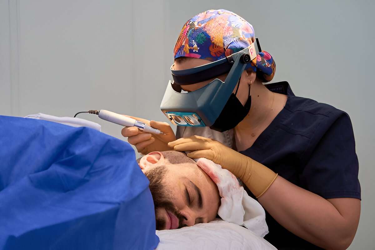 Are There Any Side Effects of a Hair Transplant?