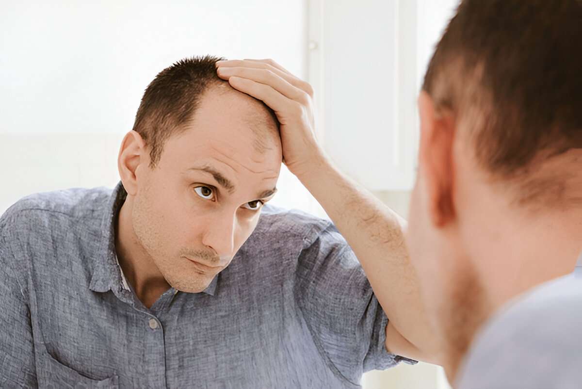 What British Men Should Know Before Going Bald