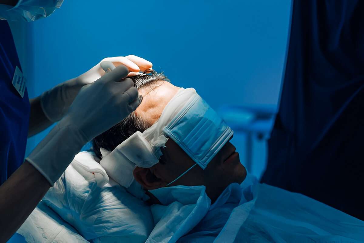 manual hair transplant London