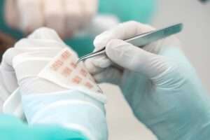 What Happens If Your Hair Transplant Doesn’t Grow?