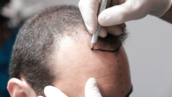 hair fibers for men