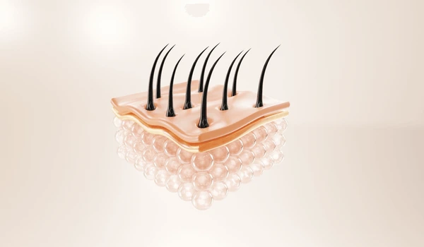 Can You Have a Second Hair Transplant if Hair Loss Progresses?